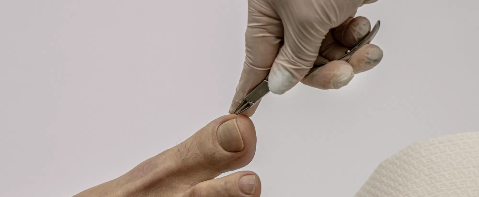 Tretmani problema i bolesti noktiju stopala